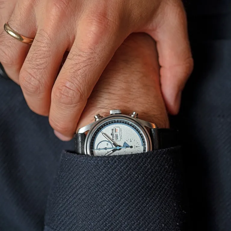 Comment adopter le strass dentaire papillon pour un sourire tendance